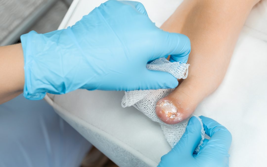 Innovación en salud: Dispositivo que salva extremidades diabéticas