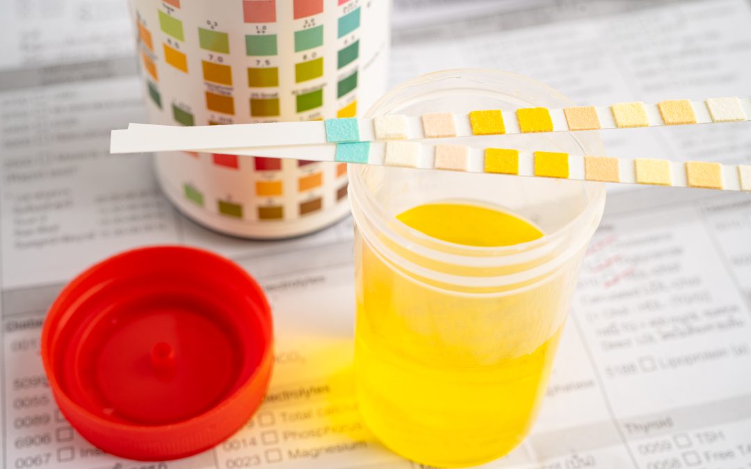 Hidratación efectiva: El secreto está en el color de tu orina