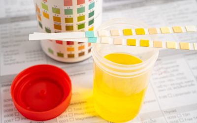 Hidratación efectiva: El secreto está en el color de tu orina